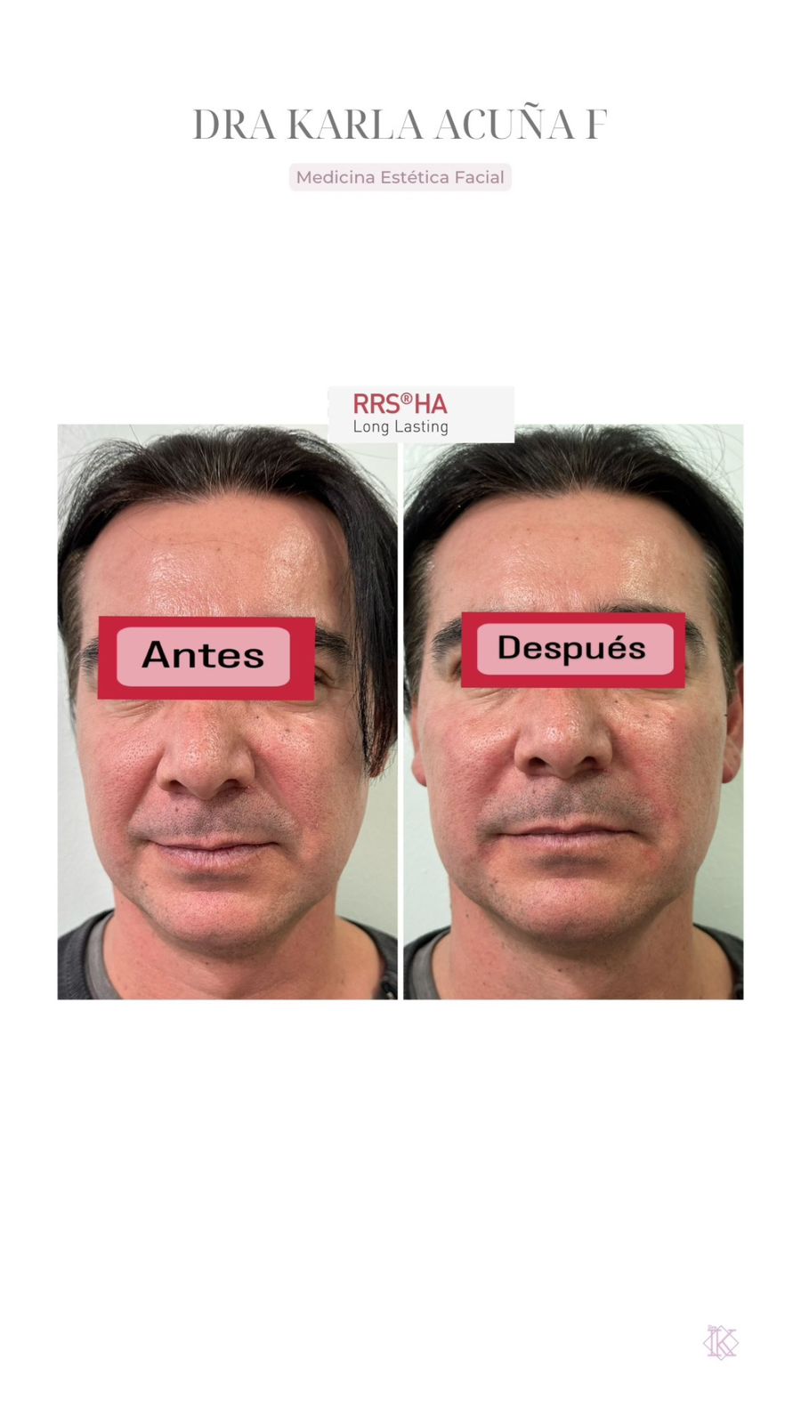 Dra. Karla Acuña F.