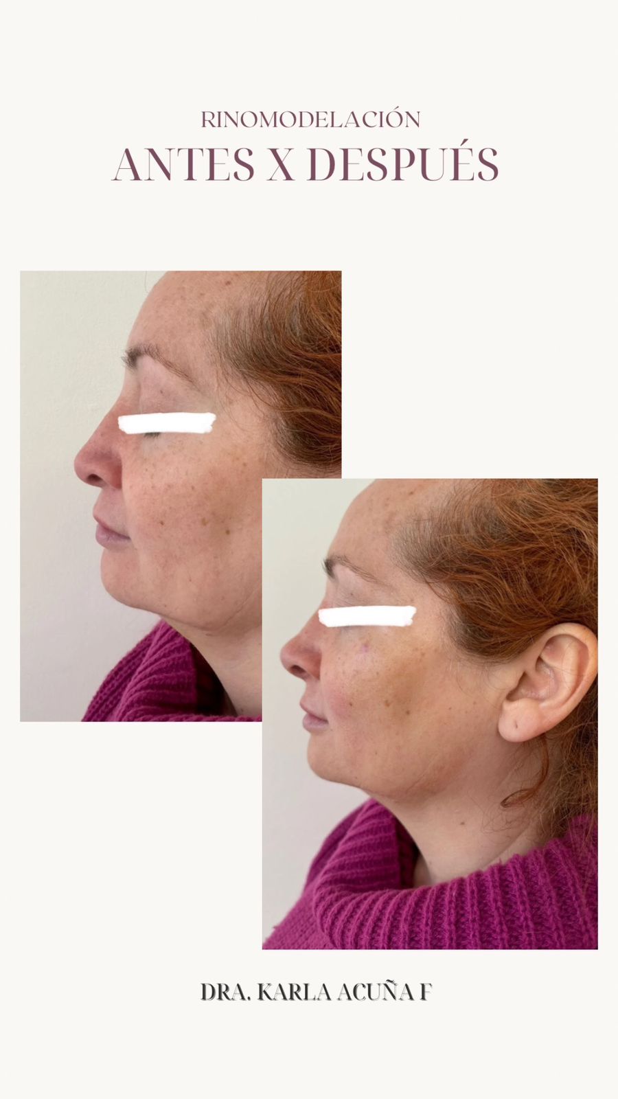 Dra. Karla Acuña F.